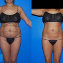 Before and after seven monhts later