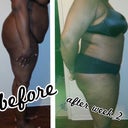 before and after..different in 1 week apart..I'm 12 days post op..