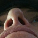 This is AFTER revision rhinoplasty.