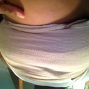 After surgery, while I was still in ace wrap  day 2