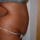 Physicians before pic
