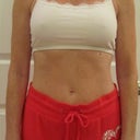 1 Week Post-Op