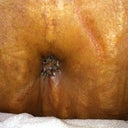 My BEAUTIFUL belly button.  He did a perfect job on it
