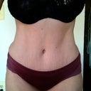 15 weeks post op
