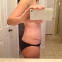 21 dpo, Bruises are almost gone.  Excited about final outcome and seeing changes from wk to wk.