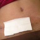 Pod 23 Incision line is really thin I'm happy about that. BB has Vaseline on it to keep it moist. I still have a few stretch marks not to bad. I 'm planning on getting a professional tattoo artist to tattoo over it later on when I'm fully healed. I'm look into some sexy tattoos ...I thinking of drawing my own tattoos since there aren't much out there I like.