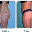 Dr. Salzhauer's work