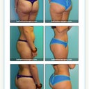 Dr. Salzhauer's work