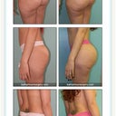 Dr. Salzhauer's work