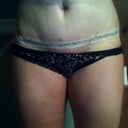 PO day 7