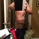 POST OP DAY 8