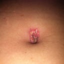 My BB is looking a little gross, I have a call I to my PS to see if I need to do anything!