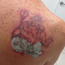 immediately after 4th treatment