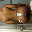 Took off for 1 hour post op 3