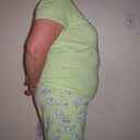 Before surgery