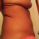 Before surgery