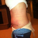 2 Weeks Left Side