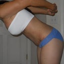 3 weeks post op - bent over side view