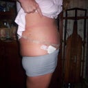 11-8-11 after doctors visit