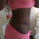 7 months after  (vacation pic)