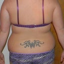 Before- Back View