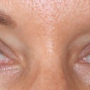 Me- Before(without makeup)