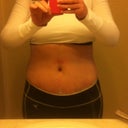 2 week post op