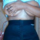 front view 2 days post op and almost standing upright