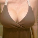 7 days post op.