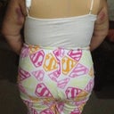 This is my sister 8 days post op, now keep in mind that she was realistic of her expectations so she is excited for not having the huge rolls on each of her sides and having a smaller waist but shes also glad that her butt is fuller yet matches her body. She is 8 days post op.