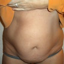 Before pic.