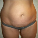 Before Pic.
