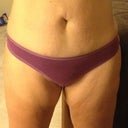 Before Front