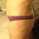 Before Side