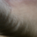 Hairline