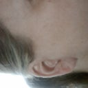 Right ear front