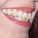 See how top front teeth don't follow the natural arch but face straight forward.