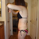 side profile 2 wk PO