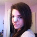 Day 2 My eyes are so puffy and swollen! I covered up my undereye bruising with make up