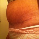Swell hell after going to a kid's party....