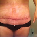 Swollen.