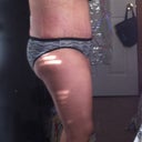 Left - three days post op