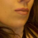 Before..plus lipliner to make them look bigger