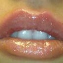 Right after they were done-you can see the injection sites. which go away soon :)