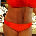 5 weeks po.. Swelling galore