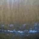 Tried to get a close up of my incision so you can see how thin it is.  I still have some of the white cream Dr. Robles used on it.