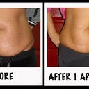 Stomach Before & After