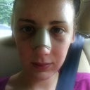 2 days post-op... swelling was starting to get worse.. my eyes were getting puffy and my bruises started getting much darker. I felt fine day 1 but day 2, I started feeling crappy.