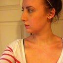 This was the day after I got my cast removed! I was still pretty swollen but here's the side view :) feeling much better, bruises went down a lot (but makeup did help a LOT)