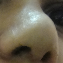 I SO HATE MY NEW NOSE!